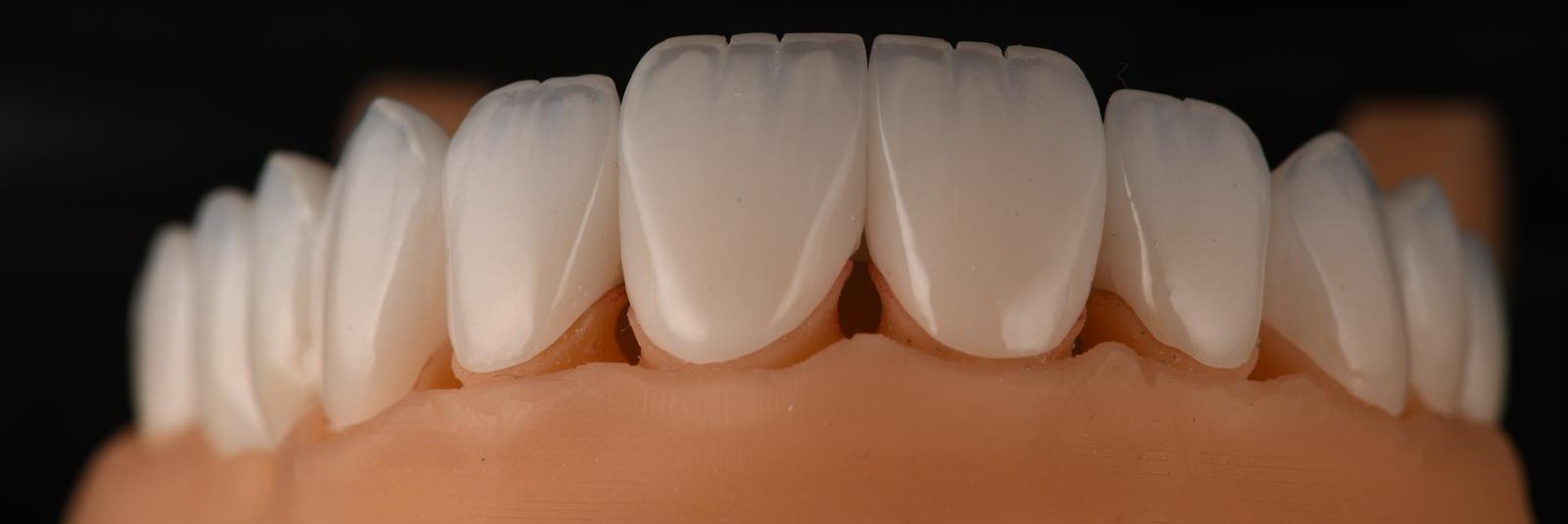 Zircon Layer Ceramic